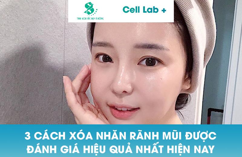 3 CÁCH XÓA NHĂN RÃNH MŨI ĐƯỢC ĐÁNH GIÁ HIỆU QUẢ NHẤT HIỆN NAY