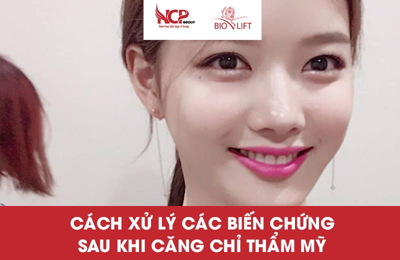 CÁCH XỬ LÝ CÁC BIẾN CHỨNG SAU KHI CĂNG CHỈ THẨM MỸ