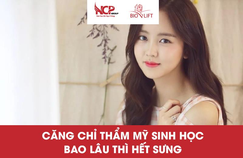 CĂNG CHỈ THẨM MỸ SINH HỌC BAO LÂU THÌ HẾT SƯNG