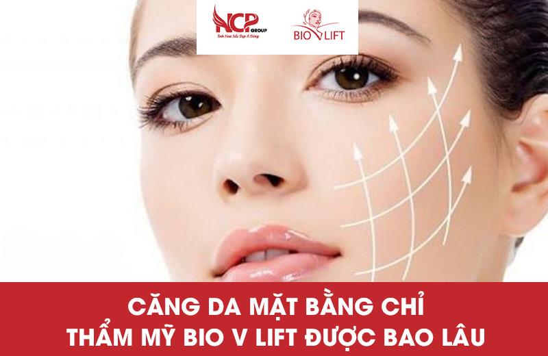 CĂNG DA MẶT BẰNG CHỈ THẨM MỸ BIO V LIFT ĐƯỢC BAO LÂU