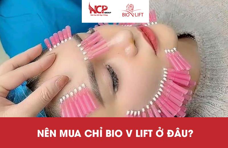 NÊN MUA CHỈ BIO V LIFT Ở ĐÂU